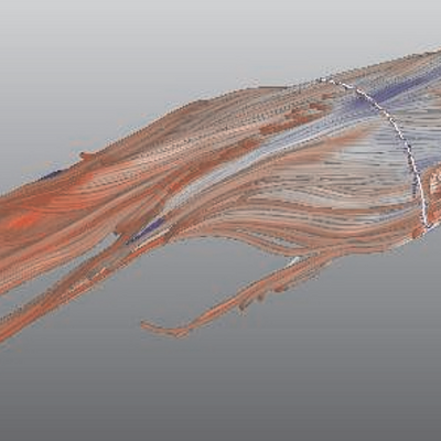 Fiber tracking of muscle in human forearm. 