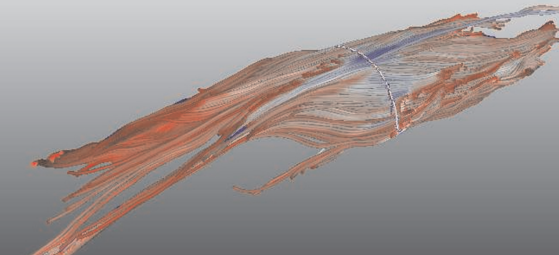 Fiber tracking of muscle in human forearm. 
