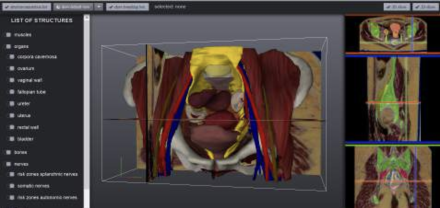 Screenshot of our interactive web application, which allows users to explore linked 2D and 3D anatomy contained in the VSP atlas.