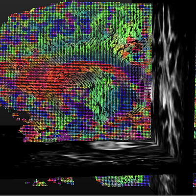 Saggital view of DT ellipsoids generated for a healthy Human Brain