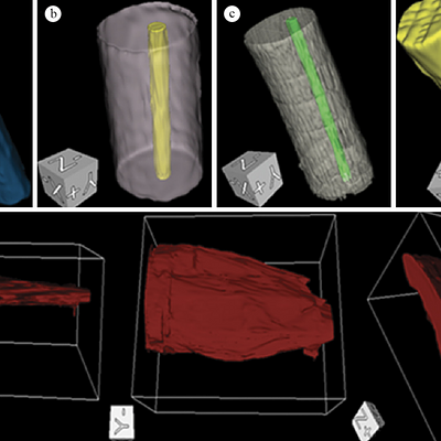 Typical 3D-UBM images of the four phantoms and for the rat right-side hindlimb lateral gastrocnemius at different view angles, generated after segmentation using the TurtleSeg software. (a) PH01LCY, (b) PH10SCY, (c) PH10SSCY, (d) PH10LCO and (e) lateral gastrocnemius.