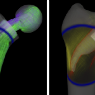 Interactive visualizations of simulated stress tensor fields for a human femur under load