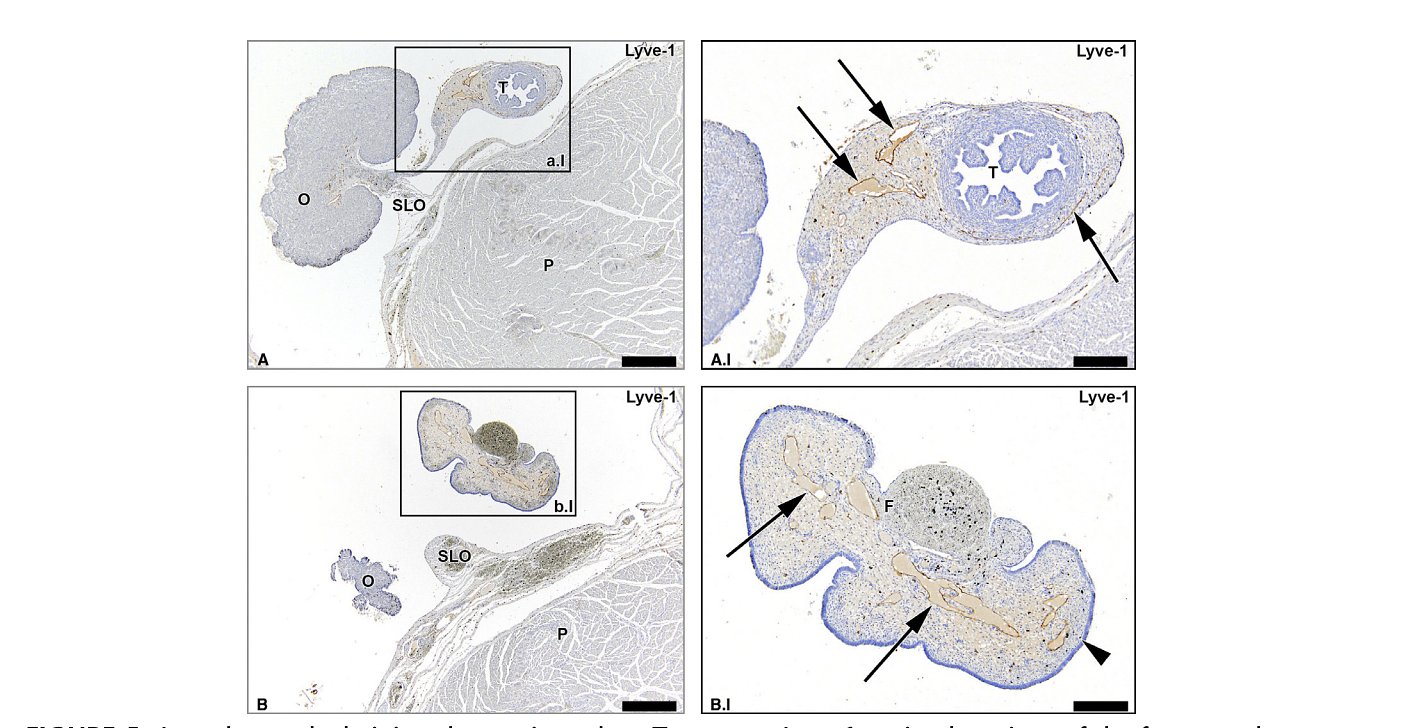 Lymph vessels draining the uterine tubes. Transverse Lyve-1Ystained sections of the fetus aged 15 weeks showing that lymph vessels draining the uterine tubes (arrows) run in the mesosalpinx. Note the substantial amount of lymph vessels along the entire length of the uterine tubes until its fimbriae (F). O indicates ovary; T, uterine tube; P, psoas major muscle. Scale bar overview, 500 Km; scale bar detail, 200 Km.