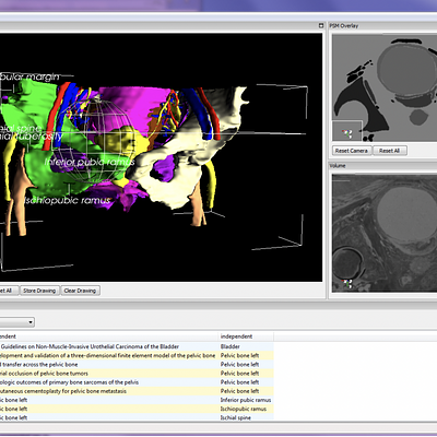 Spatial querying through sphere selection. A distance query reveals the literature and anatomical landmarks associated to the structures within the selection sphere.
