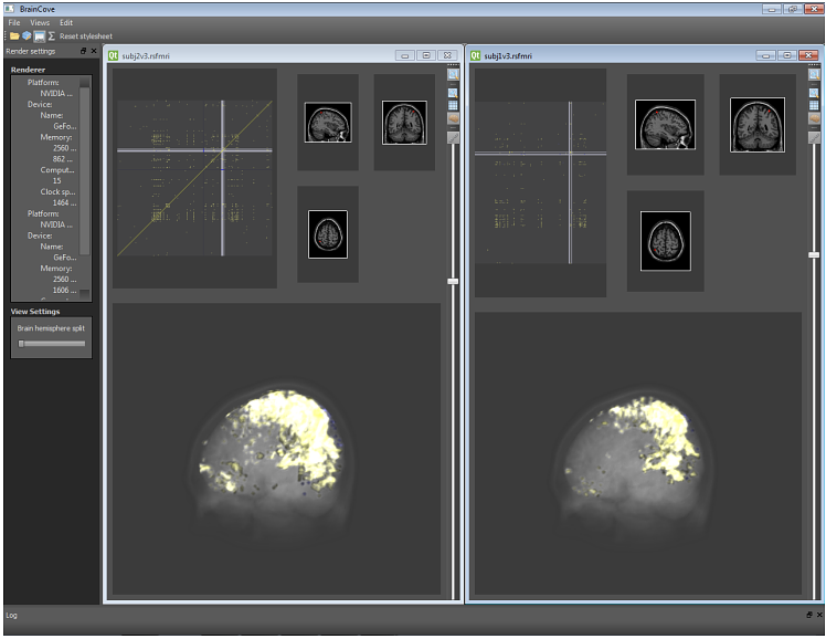 An overview of the application window with two datasets. Each dataset is opened in its own child window. Each child window contains of three views: the pixmap view on the top-left, the slice views on the top right and the anatomical view on the bottom.