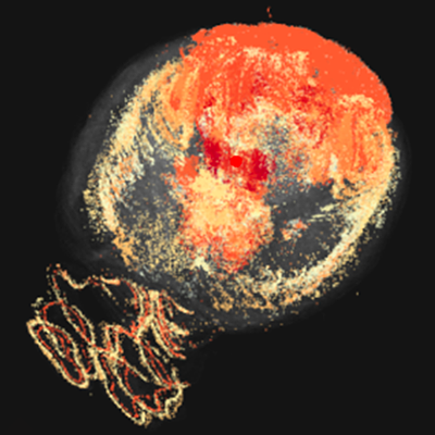 3D visualization of gene expression across a complete mouse brain