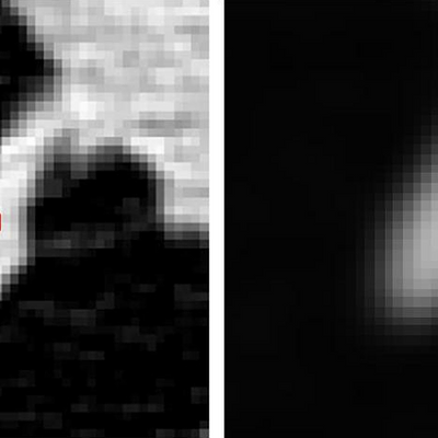 From left to right: Axial slice with boxed polyp; enlarged polyp, squares denote two locations, the left one is in air and the right one inside the polyp; Gaussian filtered result (σ =2.0 mm); Bilateral filtered result (σ dis = 3.0 mm and σ int = 250 HU)