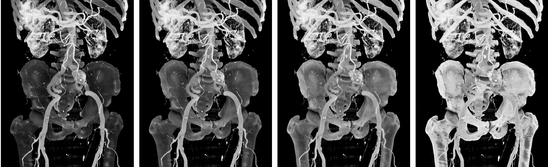Effect of the normal factor