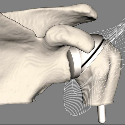  The visualisation of ROM by means of envelopes.