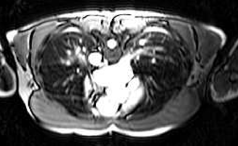  Slice of the MRI of the heart taken from the down-up sequence.