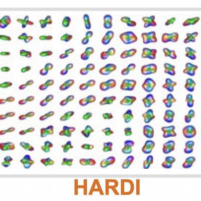 This figure shows glyph visualizations of HARDI and DTI-images of a 2D-slice in the brain where neural fibers in the corona radiata cross with neural fibers in the corpus callosum. Here DTI and HARDI are visualized differently; HARDI is visualized according to Def. 1, whereas DTI is visualized using Eq. (1).