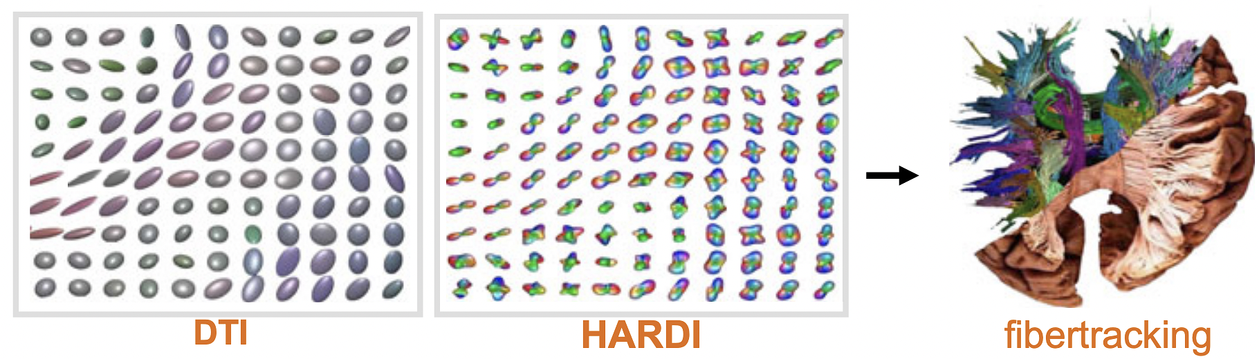 This figure shows glyph visualizations of HARDI and DTI-images of a 2D-slice in the brain where neural fibers in the corona radiata cross with neural fibers in the corpus callosum. Here DTI and HARDI are visualized differently; HARDI is visualized according to Def. 1, whereas DTI is visualized using Eq. (1).