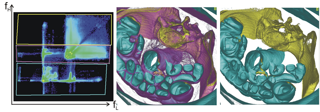 Abdominal CT scan