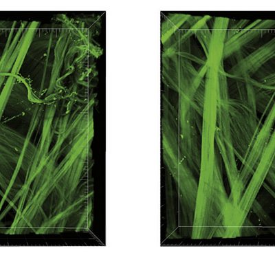 Collagen fibers in the adventitia of the carotid artery (sample 1). The same area was imaged at different pressure steps from 0 to 140 mm Hg; eight intermediate steps are shown. The gradual straightening of (individual) fibers is observed. The biggest configuration change mainly occurs between 40 and 80 mm Hg.