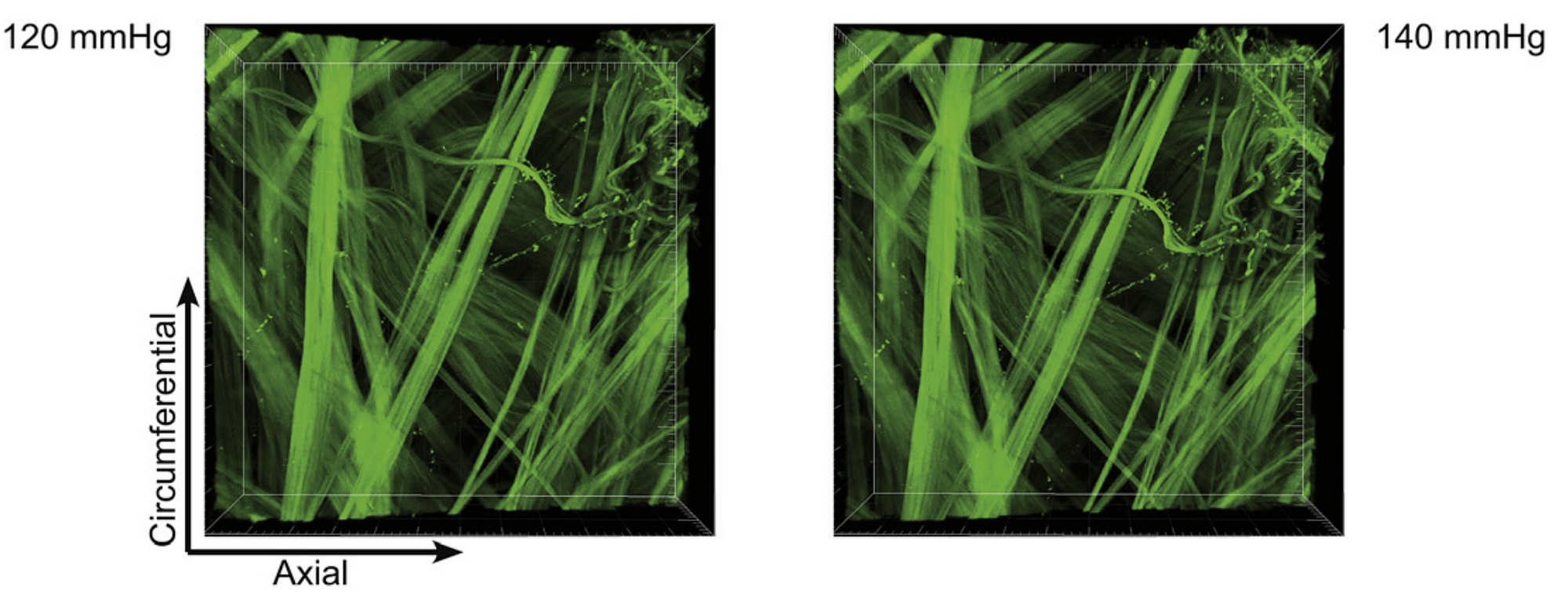Collagen fibers in the adventitia of the carotid artery (sample 1). The same area was imaged at different pressure steps from 0 to 140 mm Hg; eight intermediate steps are shown. The gradual straightening of (individual) fibers is observed. The biggest configuration change mainly occurs between 40 and 80 mm Hg.