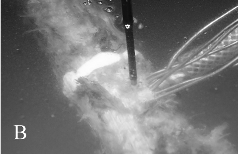 Example of a femur equipped with thermocouples, a close up of the measurement location.