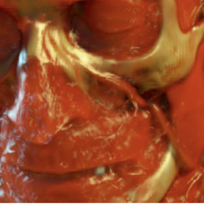 From left to right: rendering of the publicly available bonsai data set, which demonstrates that our method is able to render very thin participating media, Manix and Backpack data set. The examples illustrate how volumetric and surface scattering can be effectively combined in a single volume rendering