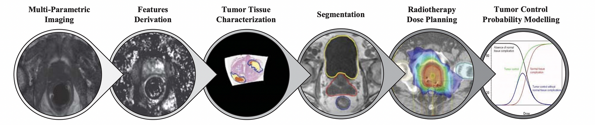 Schematic depiction of the steps of the patient-specific radiotherapy planning pipeline, employed in clinical research to create personalized, tumor-tailored radiotherapy plans.