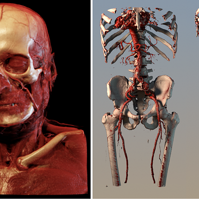 Two examples of interactive visualizations made with the volume renderer of Kroes et al. 