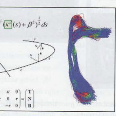 Voorspellen van visueel functieverlies door epilepsiechirurgie