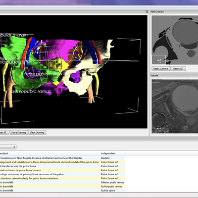 A distance query returns all information related to the structures inside the sphere.