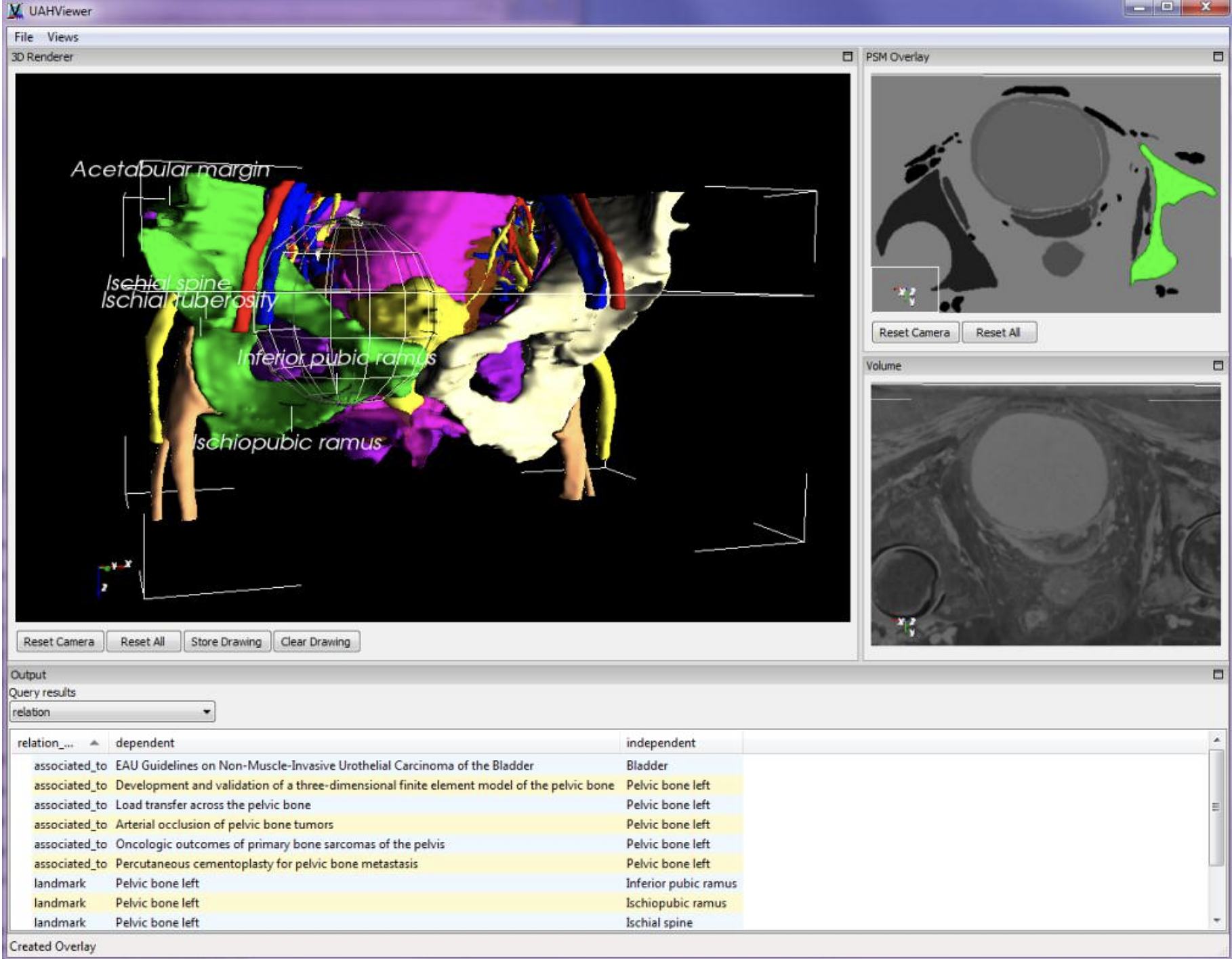 A distance query returns all information related to the structures inside the sphere.