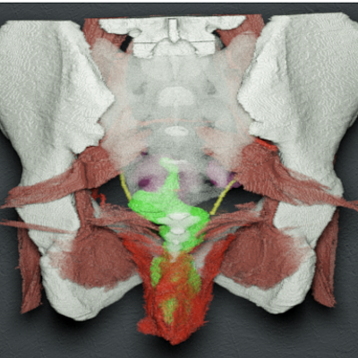Visualization for antomical exploration of the rectum (green) and levator ani muscle (red) of a segmentation label volume based on the Visible Korean Human cryosectional dataset. The declarative query in this case is “Show me the rectum and the nearby surrounding musculature”.