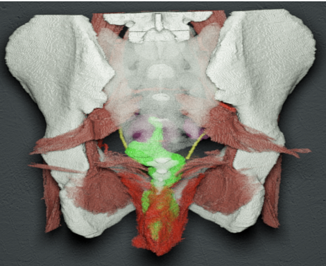 Visualization for antomical exploration of the rectum (green) and levator ani muscle (red) of a segmentation label volume based on the Visible Korean Human cryosectional dataset. The declarative query in this case is “Show me the rectum and the nearby surrounding musculature”.