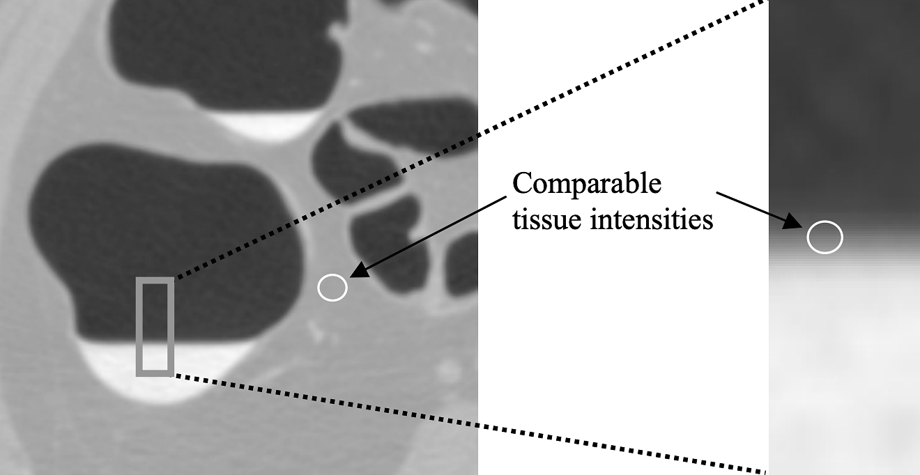 Intensity values on a boundary can be similar to single material intensities through convolving with the PSF. 