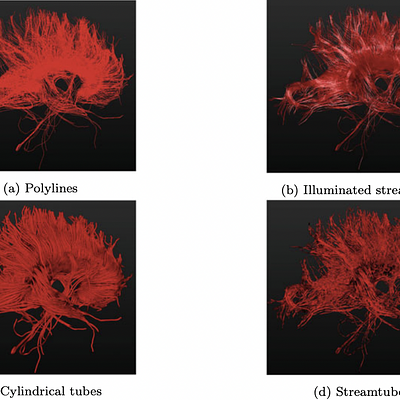 Visualization techniques for deterministic tractography. Images are generated using vIST/e