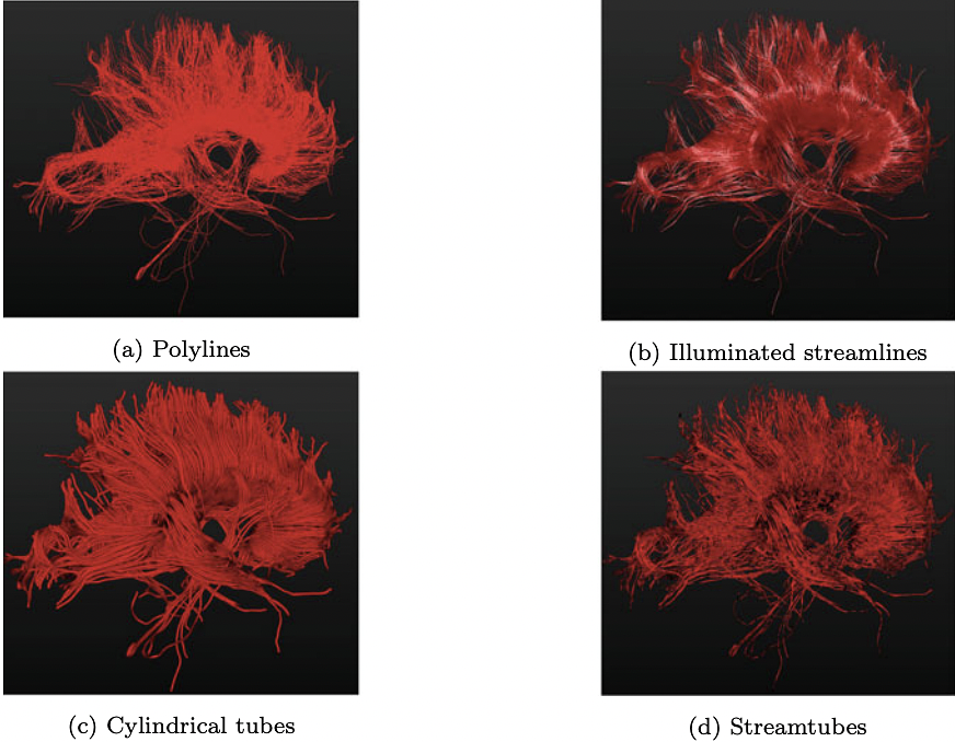 Visualization techniques for deterministic tractography. Images are generated using vIST/e