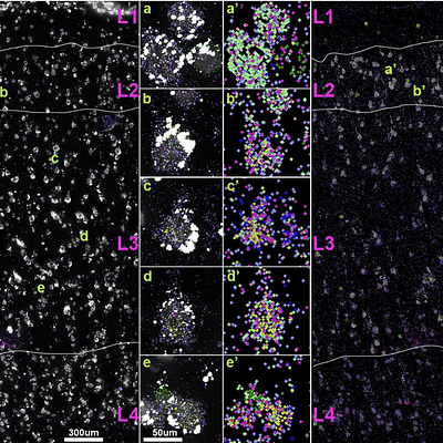  Single molecule (sm)FISH analysis of gene expression levels in human MTG layers 2 and 3