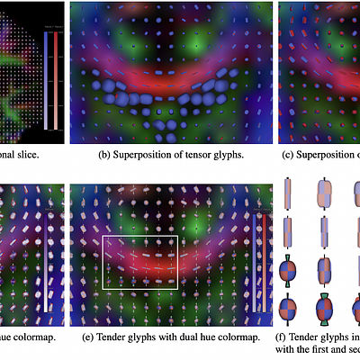 The application of the Tender glyphs to compare two DTI datasets acquired with different b-values.