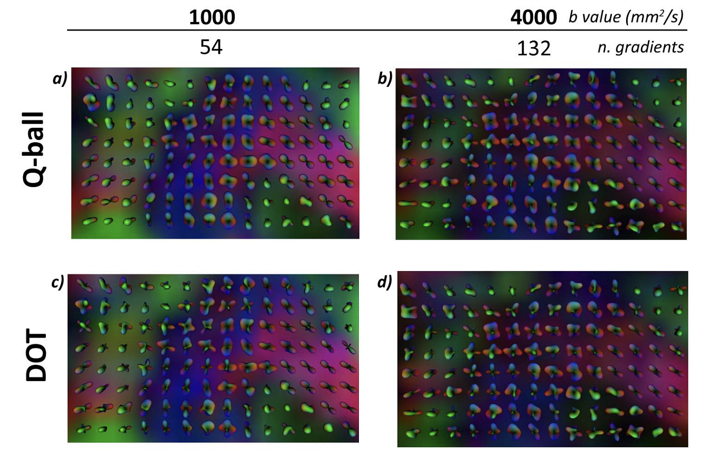In vivo results of the brain area of  corpus callosum and corona radiate.