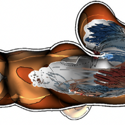 Three subsequent time steps of the animated pathlines in a vessel. The cutaway technique facilitates insight into the vessel during the animation of the blood flow. Furthermore, arrow glyphs represent the flow’s pathlines.