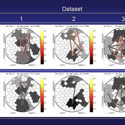 FU maps for multichannel EEG coherence visualization. Brain responses were collected from three subjects using an EEG cap with 119 scalp electrodes. During a so-called P300 experiment, each participant was instructed to count target tones of 2000Hz (probability 0.15), alternated with standard tones of 1000Hz (probability 0.85) which were to be ignored. After the experiment, the participant had to report the number of perceived target tones. Shown are FU maps for target stimuli data, with FUs larger than 5 cells, for the 1-3Hz EEG frequency band (top row) and for 13-20Hz (bottom row), for three datasets.