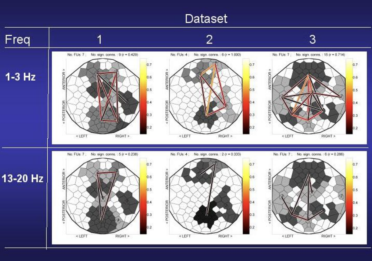 FU maps for multichannel EEG coherence visualization. Brain responses were collected from three subjects using an EEG cap with 119 scalp electrodes. During a so-called P300 experiment, each participant was instructed to count target tones of 2000Hz (probability 0.15), alternated with standard tones of 1000Hz (probability 0.85) which were to be ignored. After the experiment, the participant had to report the number of perceived target tones. Shown are FU maps for target stimuli data, with FUs larger than 5 cells, for the 1-3Hz EEG frequency band (top row) and for 13-20Hz (bottom row), for three datasets.