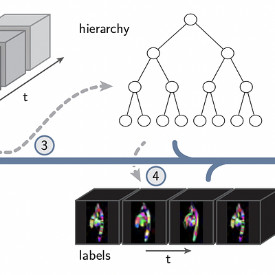 Overview of the visualization framework, based on spatiotemporal hierarchical clustering. The gray dashed arrows depict pre-processing steps. (1) A tMIP volume is generated, and (2) an iso-threshold captures the voxels that are clustered. (3) Next, the cluster hierarchy is constructed. (4) Using the cluster tree, labels are generated per cardiac phase. After preprocessing, the real-time visualization is generated using the available data structures, as depicted by the solid blue arrow.