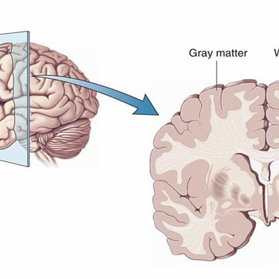 White Matter and Gray Matter in the Human Brain