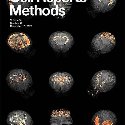 Cover Image of the Corresponding Cell Reports Methods Issue