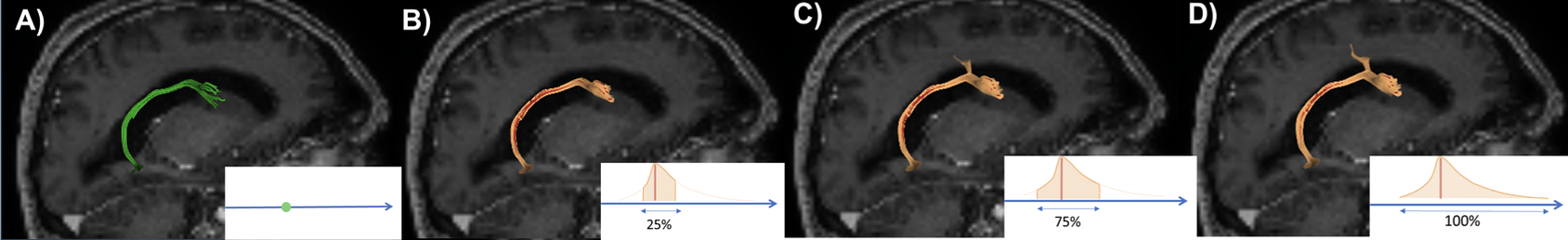 Figure showing fiber tracking uncertainty with various thresholds