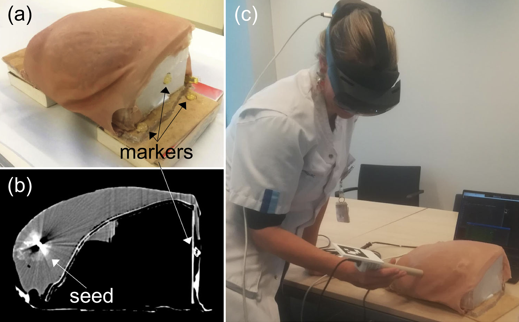 a Breast phantom with a magnetic seed inside and markers outside. b Computed tomography slice of the breast phantom. c Seed localization demo with a surgeon